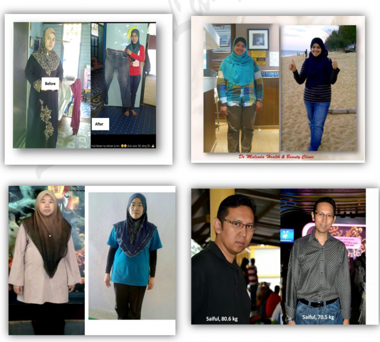 HCG Injection Treatment Testimonial